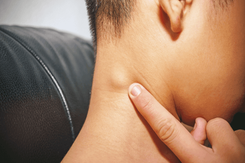 All You Need To Know About Swollen Occipital Lymph Nodes